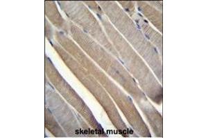 TRMT2B Antibody (N-term) (ABIN655117 and ABIN2844748) immunohistochemistry analysis in formalin fixed and paraffin embedded human skeletal muscle followed by peroxidase conjugation of the secondary antibody and DAB staining. (TRMT2B Antikörper  (N-Term))