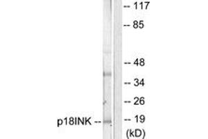 Western blot analysis of extracts from COS7 cells, using p18 INK Antibody. (P18 INK Antikörper  (AA 111-160))