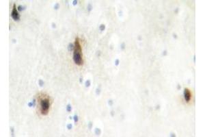Immunohistochemistry analyzes of MVK antibody in paraffin-embedded human brain tissue. (MVK Antikörper)