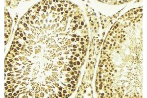 ABIN6267669 at 1/100 staining Mouse testis tissue by IHC-P. (CAMK4 Antikörper  (pThr200))