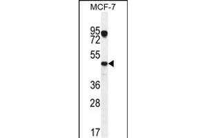 VEGF3 Antibody (N-term) (ABIN655891 and ABIN2845292) western blot analysis in MCF-7 cell line lysates (35 μg/lane). (VEGFC Antikörper  (N-Term))