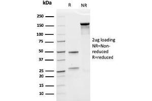 SDS-PAGE Analysis Purified EPO Recombinant Mouse Monoclonal Antibody (rEPO/1367).
