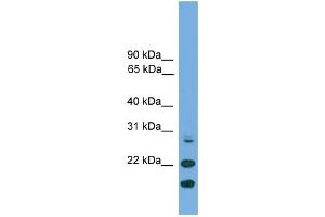WB Suggested Anti-ASF1A Antibody Titration: 0. (ASF1A Antikörper  (N-Term))