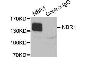 Immunoprecipitation analysis of extracts of K562 cells, using NBR1 antibody (ABIN5972123). (NBR1 Antikörper)