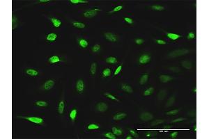Immunofluorescence of purified MaxPab antibody to EPB41L1 on HeLa cell. (EPB41L1 Antikörper  (AA 1-779))