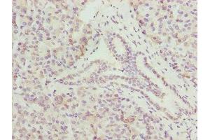 Immunohistochemistry of paraffin-embedded human pancreatic tissue using ABIN7148645 at dilution of 1:100 (CMC1 Antikörper  (AA 1-106))