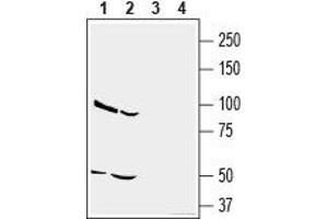 Western blot analysis of human U-87 MG glioblastoma cell line lysate (lanes 1 and 3) and human MDA-MB-231 breast adenocarcinoma cell line lysate (lanes 2 and 4): - 1,2. (CD73 Antikörper  (Extracellular, N-Term))