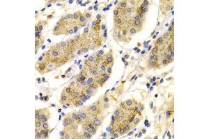 Immunohistochemistry of paraffin-embedded Human gastric using PRG2 antibody at dilution of 1:100 (x400 lens). (PRG2 Antikörper  (AA 17-222))