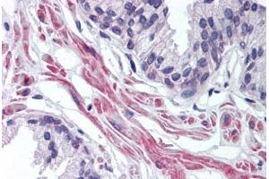 Human Prostate (formalin-fixed, paraffin-embedded) stained with FNTA antibody ABIN298038 at 10 ug/ml followed by biotinylated goat anti-rabbit IgG secondary antibody ABIN481713, alkaline phosphatase-streptavidin and chromogen. (FNTA Antikörper  (AA 150-250))