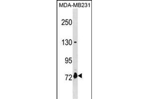 ASNSD1 Antibody (Center) (ABIN1881075 and ABIN2838601) western blot analysis in MDA-M cell line lysates (35 μg/lane). (ASNSD1 Antikörper  (AA 380-406))