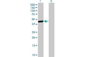 Western Blot analysis of CTH expression in transfected 293T cell line by CTH monoclonal antibody (M01A), clone 4E1-1B7. (CTH Antikörper  (AA 1-405))