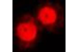 Immunofluorescent analysis of Annexin A1 staining in NIH3T3 cells.