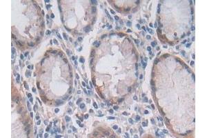 Immunohistochemistry (IHC) image for anti-2'-5'-Oligoadenylate Synthetase 2, 69/71kDa (OAS2) (AA 11-346) antibody (ABIN7436105)