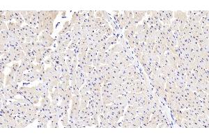 Detection of SSA1 in Human Cardiac Muscle Tissue using Polyclonal Antibody to Sjogren Syndrome Antigen A1 (SSA1) (TRIM21 Antikörper  (AA 268-465))