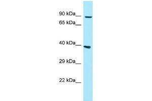 WB Suggested Anti-GPLD1 Antibody Titration: 1.