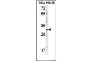 Western blot analysis in of DTWD1 Antibody (Center) Cat. (DTWD1 Antikörper  (Middle Region))