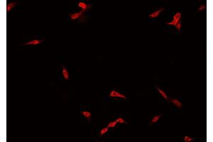 ABIN6266775 staining NCI-H929 cells by IF/ICC. (FOXH1 Antikörper  (Internal Region))