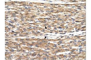 Immunohistochemistry (IHC) image for anti-Patatin-Like phospholipase Domain Containing 3 (PNPLA3) (C-Term) antibody (ABIN2783569)