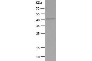 Western Blotting (WB) image for Acyl-CoA Dehydrogenase Family, Member 8 (Acad8) (AA 23-415) protein (His tag) (ABIN7121677)