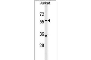 NX1 Antibody (Center) (ABIN1537796 and ABIN2848757) western blot analysis in Jurkat cell line lysates (35 μg/lane). (PANX1 Antikörper  (AA 124-152))