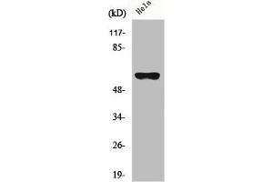 Western Blot analysis of HeLa cells using CYP27A1 Polyclonal Antibody (CYP27A1 Antikörper  (Internal Region))