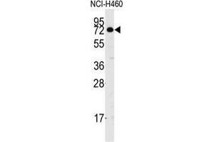Western blot analysis of anti-CASC3 Antibody in NCI-H460 cell line lysates (35 µg/lane).
