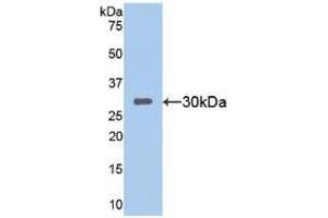 Western blot analysis of recombinant Mouse SIRT1.