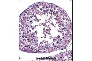 Immunohistochemistry (Paraffin-embedded Sections) (IHC (p)) image for anti-Signal Transducer and Activator of Transcription 4 (STAT4) (AA 666-695), (C-Term) antibody (ABIN657644)
