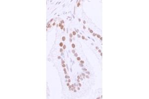 Immunohistochemistry (IHC) image for anti-Tumor Protein P53 Binding Protein 1 (TP53BP1) (AA 350-400) antibody (ABIN7448396)