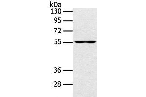 Western Blot analysis of PC3 cell using UBP1 Polyclonal Antibody at dilution of 1:200 (UBP1 Antikörper)