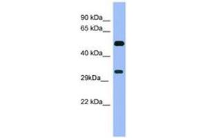 Image no. 1 for anti-Melanoma Antigen Family B, 1 (MAGEB1) (C-Term) antibody (ABIN6741714) (MAGEB1 Antikörper  (C-Term))