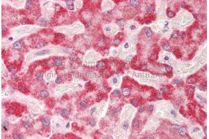 Rabbit Anti-HADH antibody Catalog Number: ARP54764 Formalin Fixed Paraffin Embedded Tissue: Human Adult Liver  Observed Staining: Cytoplasm in hepatocytes Primary Antibody Concentration: 1:600 Secondary Antibody: Donkey anti-Rabbit-Cy3 Secondary Antibody Concentration: 1:200 Magnification: 20X Exposure Time: 0. (HADH Antikörper  (Middle Region))