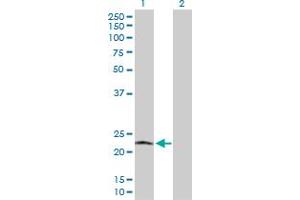 anti-Polymerase (RNA) II (DNA Directed) Polypeptide L, 7.6kDa (POLR2L) (AA 1-67) antibody