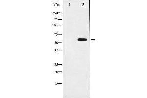 Western blot analysis of p56 Dok-2 expression in K562 whole cell lysates,The lane on the left is treated with the antigen-specific peptide. (DOK2 Antikörper  (Internal Region))