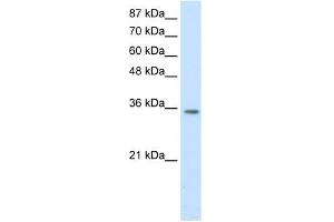 WB Suggested Anti-HOXD4 Antibody Titration:  1. (HOXD4 Antikörper  (C-Term))