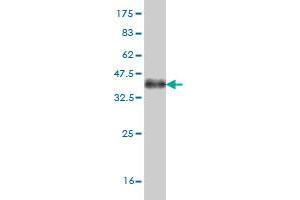 Western Blot detection against Immunogen (36. (ABL2 Antikörper  (AA 743-842))