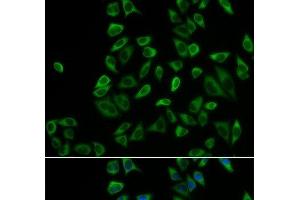 Immunofluorescence analysis of HeLa cells using PEX5 Polyclonal Antibody (PEX5 Antikörper)