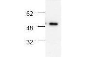 Image no. 1 for anti-Tumor Necrosis Factor Receptor Superfamily, Member 1A (TNFRSF1A) antibody (ABIN127018) (TNFRSF1A Antikörper)