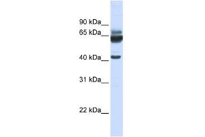 WB Suggested Anti-PARD6B Antibody Titration:  0. (PARD6B Antikörper  (N-Term))