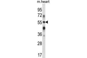 Western Blotting (WB) image for anti-UDP-Gal:betaGlcNAc beta 1,3-Galactosyltransferase, Polypeptide 2 (B3GALT2) antibody (ABIN2998023) (B3GALT2 Antikörper)