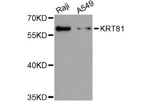 Western blot analysis of extracts of various cell lines, using KRT81 antibody (ABIN5972115) at 1:3000 dilution. (KRT81 Antikörper)
