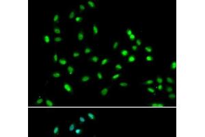 Immunofluorescence analysis of A549 cells using SMARCAD1 Polyclonal Antibody (SMARCAD1 Antikörper)