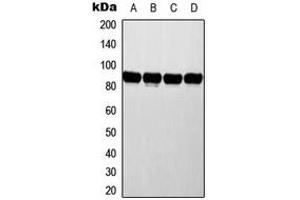 Western blot analysis of ATRIP expression in MCF7 (A), HeLa (B), NIH3T3 (C), rat liver (D) whole cell lysates. (ATRIP Antikörper  (N-Term))