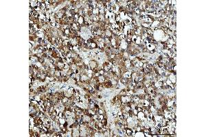 IHC analysis of XTP3TPA/DCTPP1 using anti-XTP3TPA/DCTPP1 antibody (ABIN7600677).