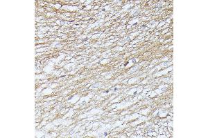 Immunohistochemistry of paraffin-embedded rat brain using Septin 5 antibody (ABIN6128759, ABIN6147556, ABIN6147557 and ABIN6216776) at dilution of 1:100 (40x lens). (Septin 5 Antikörper  (AA 1-369))