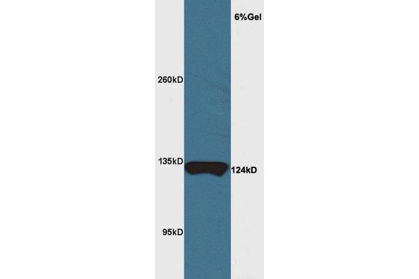 Chromosome 11open Reading Frame 9 (C11orf9) (AA 401-500) Antikörper