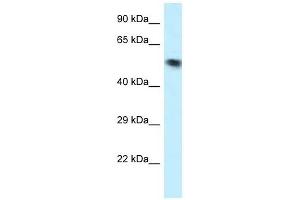 Western Blot showing VPS4B antibody used at a concentration of 1 ug/ml against OVCAR-3 Cell Lysate (VPS4B Antikörper  (N-Term))