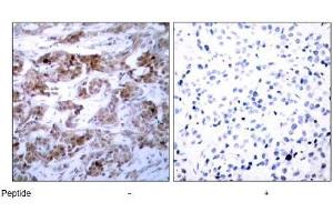 Image no. 3 for anti-B-Cell CLL/lymphoma 2 (BCL2) (Ser70) antibody (ABIN197204) (Bcl-2 Antikörper  (Ser70))