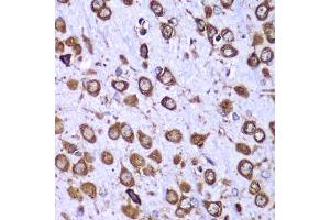 Immunohistochemistry of paraffin-embedded mouse brain using RPS10 antibody (ABIN6132945, ABIN6147192, ABIN6147194 and ABIN6221686) at dilution of 1:100 (40x lens). (RPS10 Antikörper  (AA 1-165))