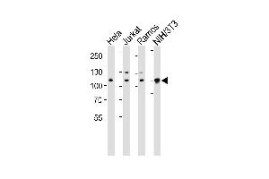 Western blot analysis of lysates from Hela, Jurkat, Ramos, mouse NIH/3T3 cell line (from left to right), using CSE1L Antibody (ABIN1882070 and ABIN2838356). (CSE1L Antikörper  (N-Term))